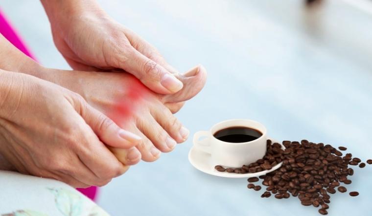 Cà phê giúp chống lại bệnh Gout